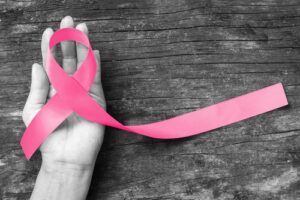breast cancer misdiagnosis