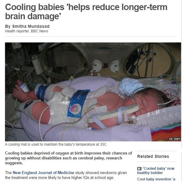 Cooling babies help reduce longer term brain damage