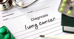 Lung Cancer Lawyer Long Island Nassau County