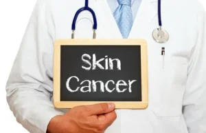 Skin Cancer Misdiagnosis Lawyer New York