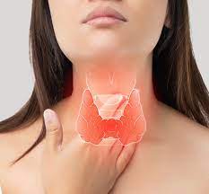 Thyroid Cancer Misdiagnosis Lawyer Westchester